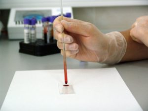A expectativa é que o exame custe menos de R$ 5 e possa ser utilizado em larga escala.